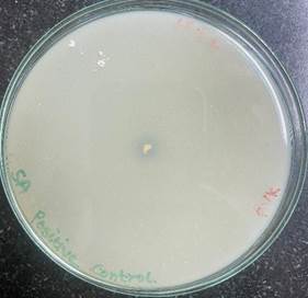 A petri dish with a white substance

Description automatically generated