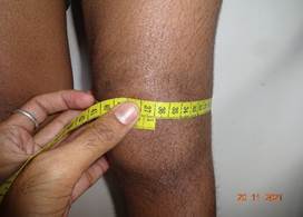 A person measuring a thigh

Description automatically generated
