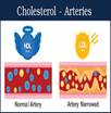 Description: Cholesterol: The Good, The Bad & The Ugly - Murray County Medical ...
